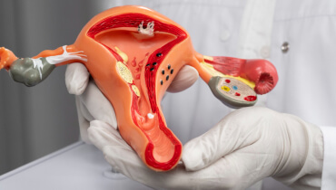 Удаление образований яичников (цистэктомия)