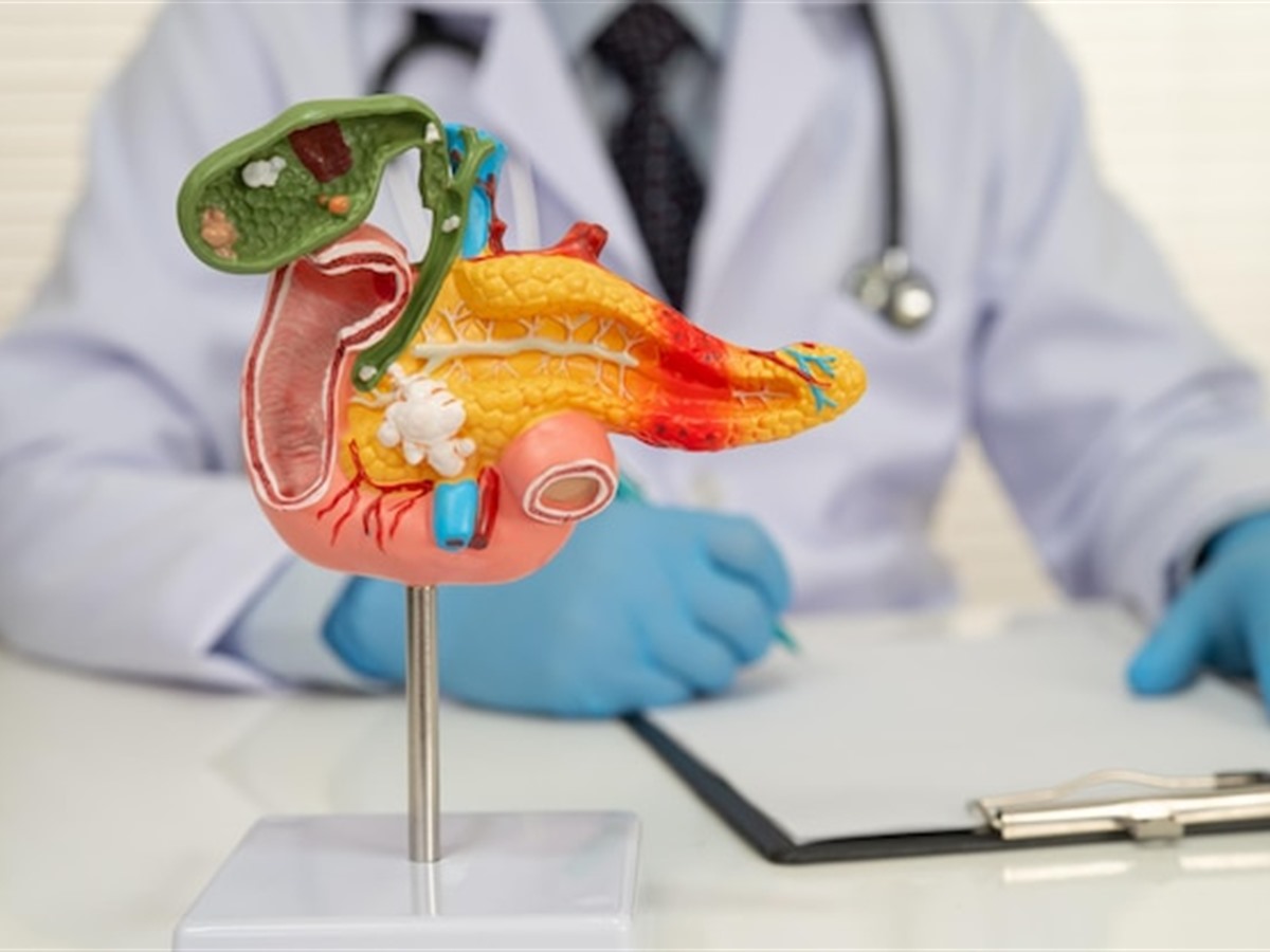 Рак поджелудочной железы