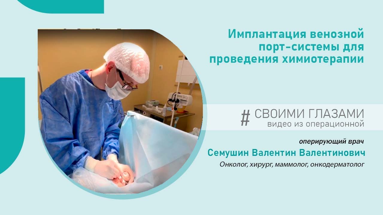 Венозная порт-система для химиотерапии. Как ее устанавливают, смотрите в нашем видео