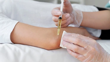 Плазмолифтинг PRP суставов