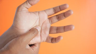 Лечение контрактуры Дюпюитрена