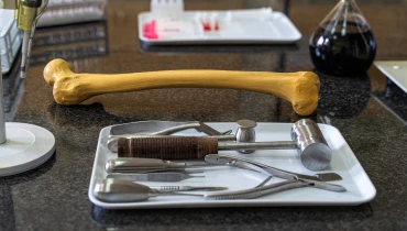 Удаление энходромы