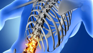 Ламинэктомия